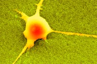 Elektronenmikroskopie einer Nervenzelle im direkten Kontakt mit nanorauer Oberfläche. Quelle: Nils Blumenthal und Prasad Shastri