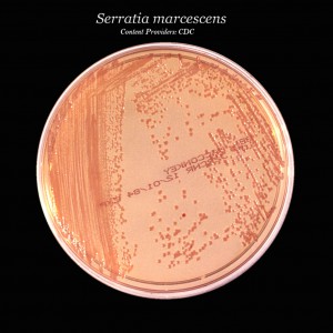 Das Bakterium serratia maracescens / Bildrechte: Centers for Disease Control and Prevention