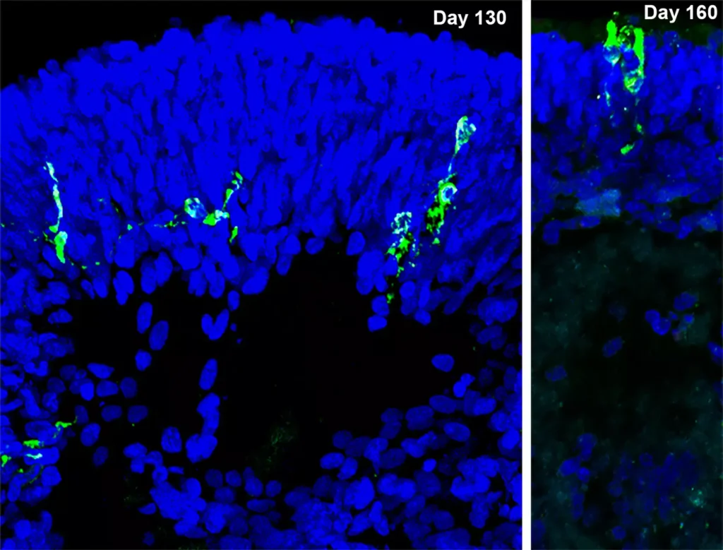 

Immunfluoreszenzaufnahmen von Sars-CoV-2 Nukleoprotein (N)-positiven Zellen (grün) zeigt Sars-CoV-2-infizierte Zellen… [mehr]

© MPI für molekulare Biomedizin/ Yotam Menuchin-Lasowski
